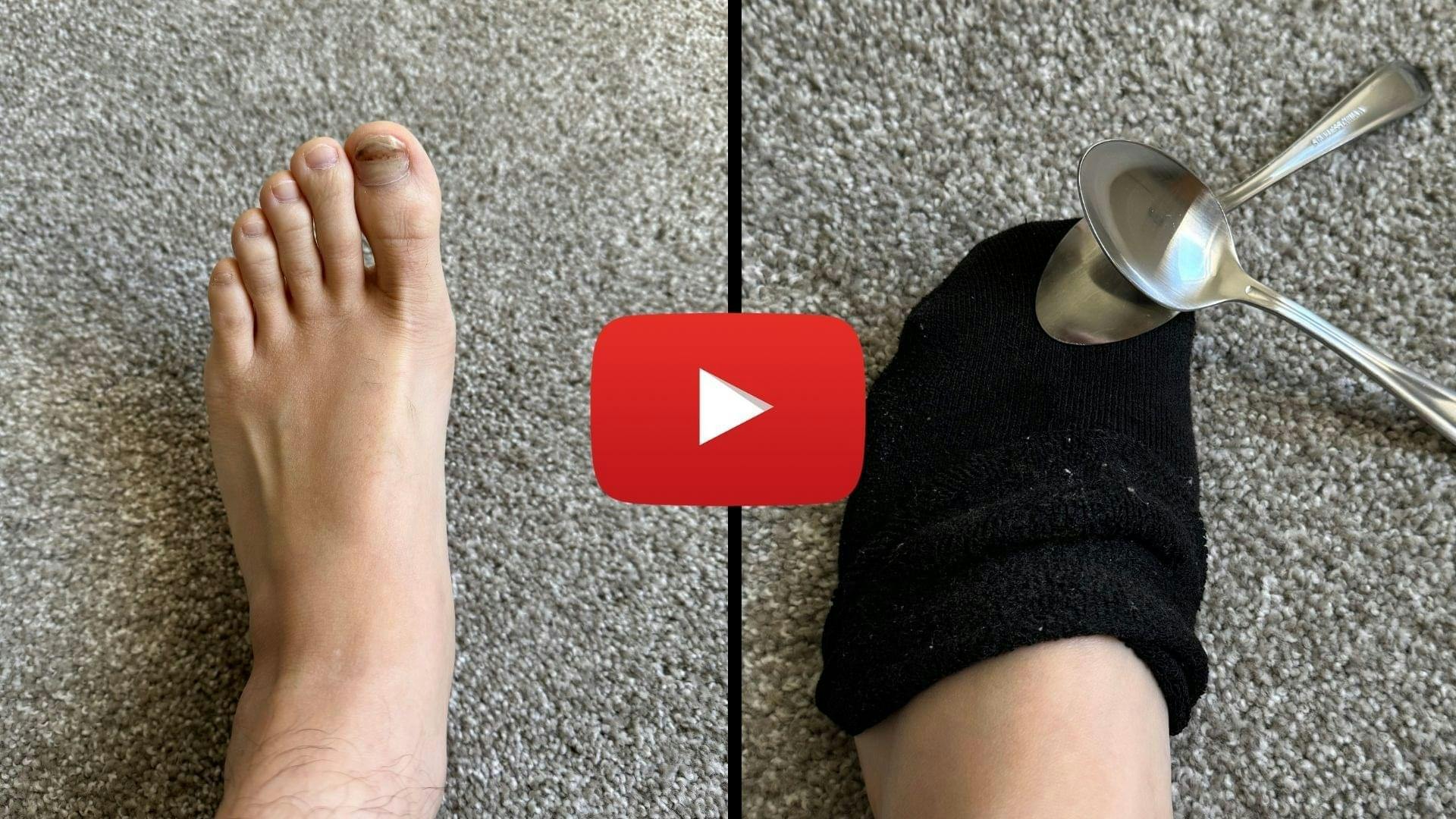 1-Minute Sock Trick Smothered My Husbands Toenail Fungus... (1)